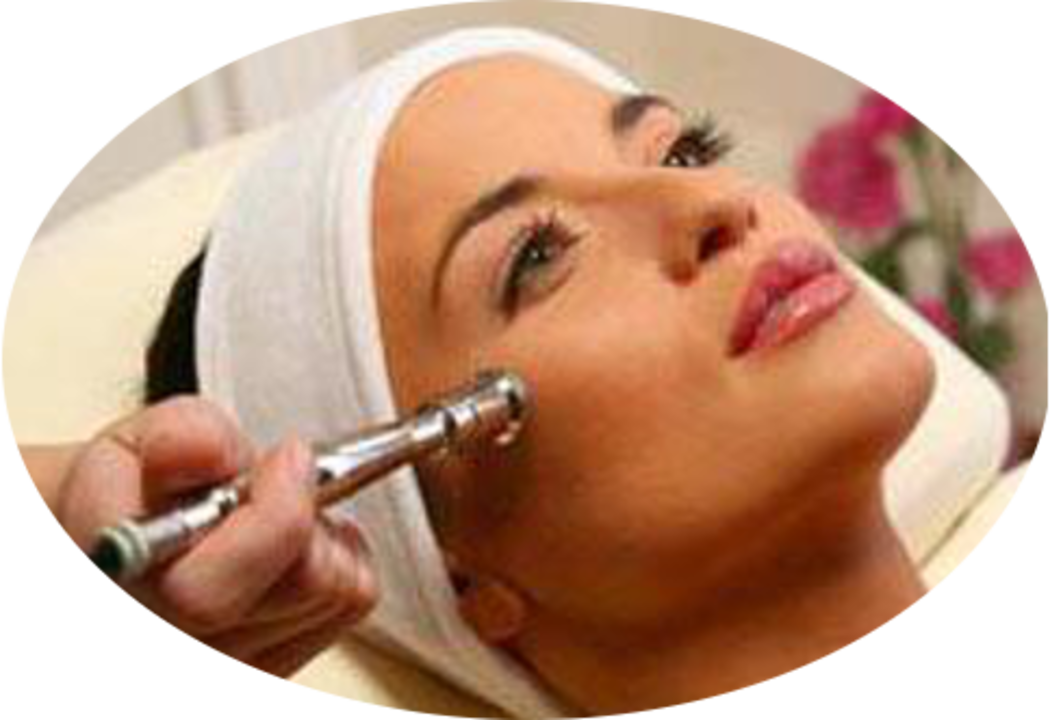 Soinmicrodermabrasion