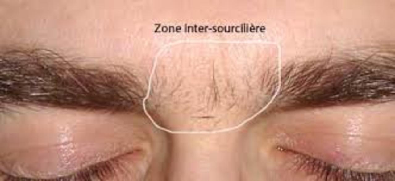 Entre sourcils1